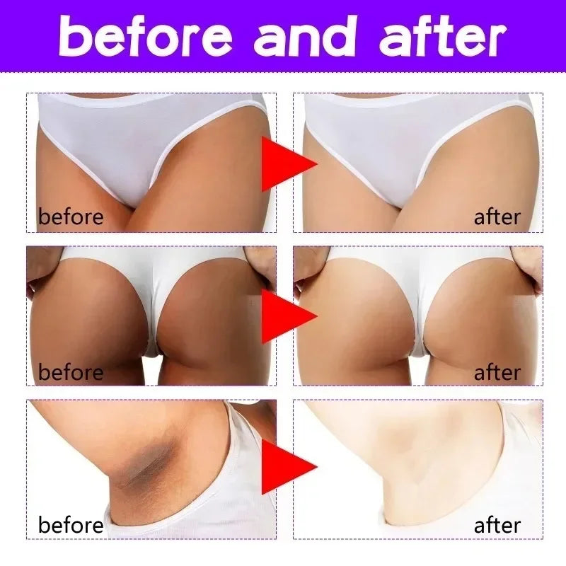 Creme clareador para Rosto e Corpo Coxas Axilas